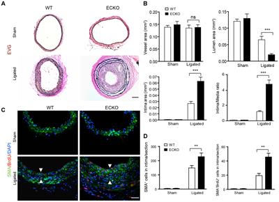 Endothelial AIP1 Regulates Vascular Remodeling by Suppressing NADPH Oxidase-2